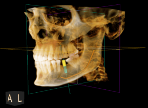 boston dental uae