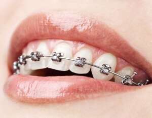 boston dental uae