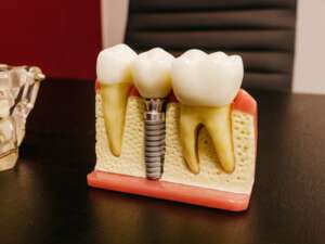 boston dental uae