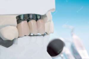 boston dental uae