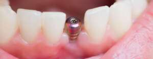 boston dental uae