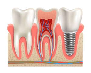 boston dental uae