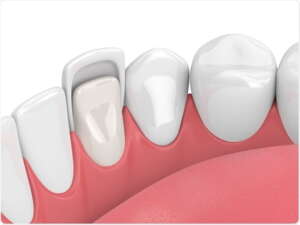 boston dental uae