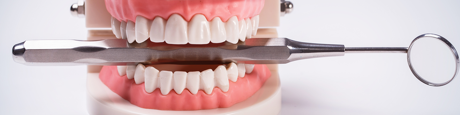 علاج قناة الجذر