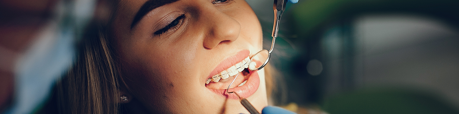 إعادة ترميم السيراميك بواسطة الكمبيوتر