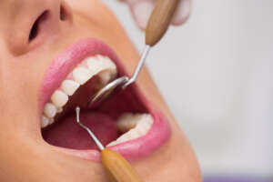 boston dental uae