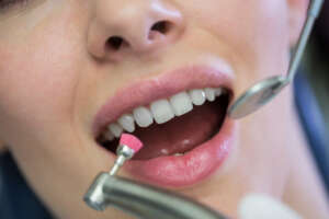 boston dental uae