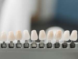boston dental uae
