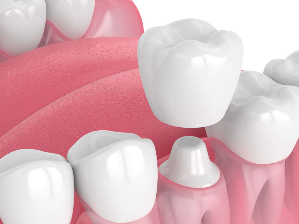 boston dental uae