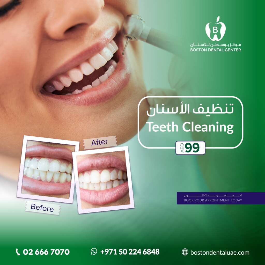 boston dental uae