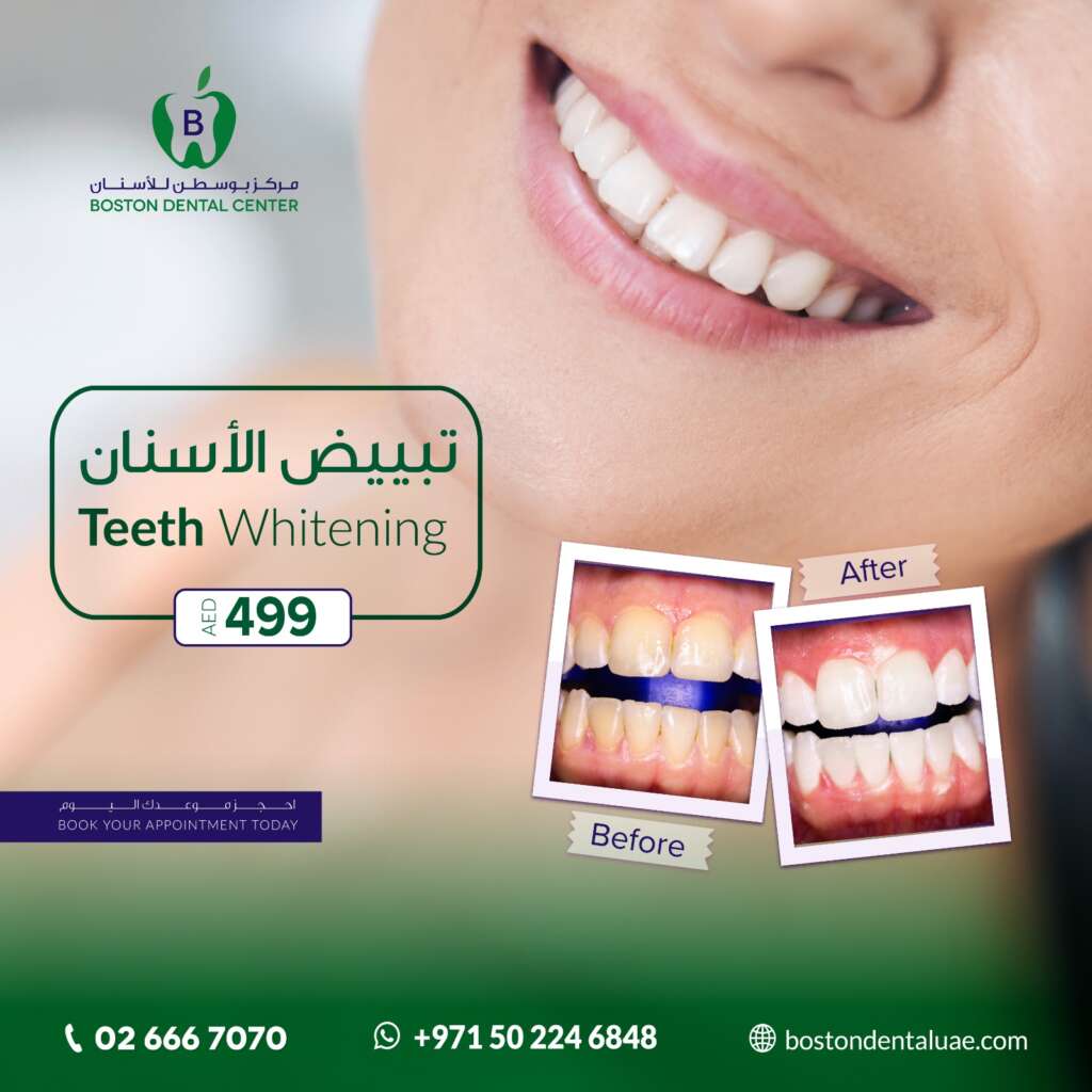 boston dental uae
