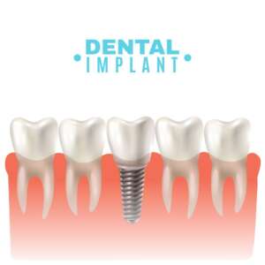 boston dental uae