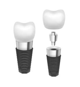 boston dental uae
