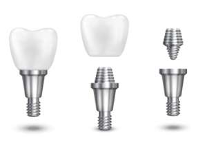 boston dental uae