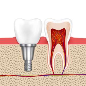 boston dental uae