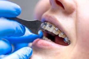 boston dental uae