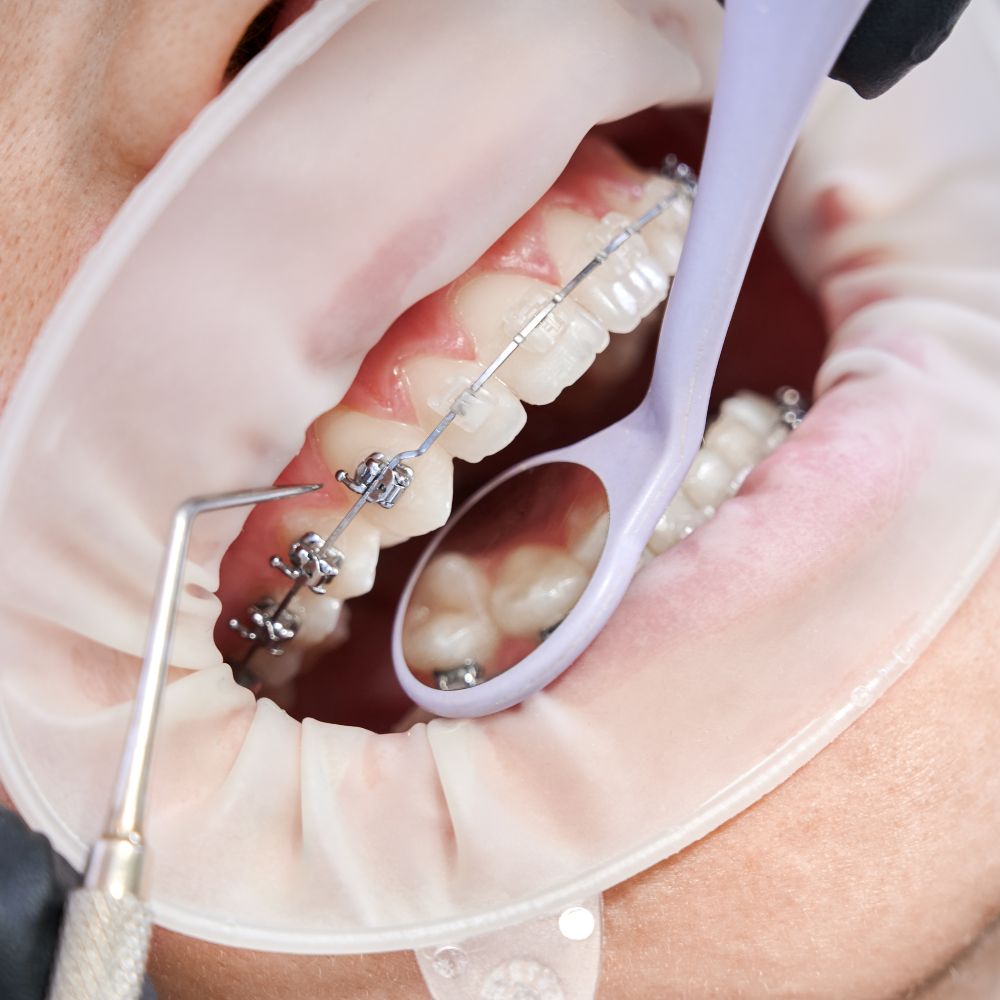 boston dental uae