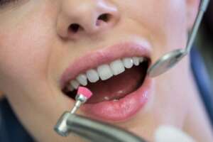 boston dental uae