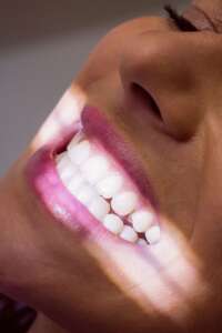 boston dental uae