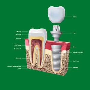 boston dental uae