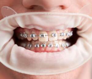 boston dental uae