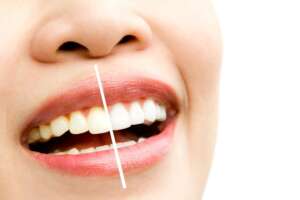 boston dental uae