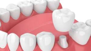 boston dental uae