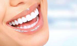 boston dental uae